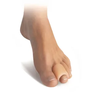Προστατευτικό Κάλυμμα Δακτύλων Σιλικόνης Ανοικτό "TOE TUBE STANDARD"